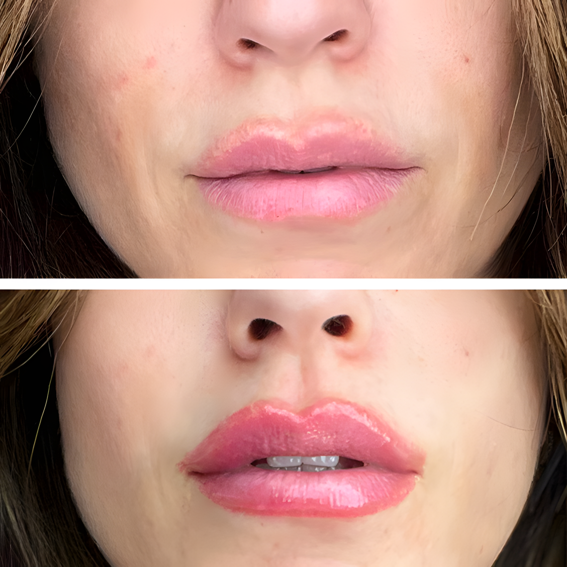 up-prima-dopo-lips-secret.png